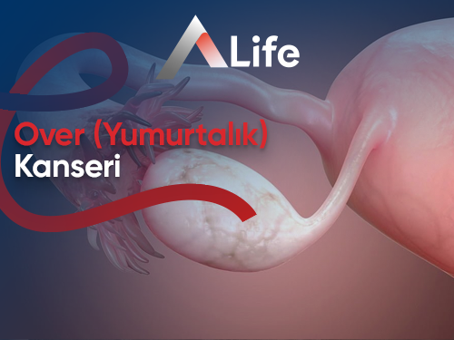 Over Kanseri (Yumurtalık Kanseri)